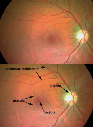 centre-ophtalmologie-la-ciotat-docteur-jerome-madar-materiel-fond-d-oeil-02-02