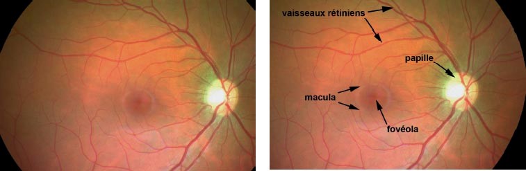 Docteur Jerome Madar Ophtalmologue La Ciotat Le Fond D Oeil