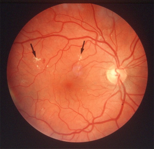 centre-ophtalmologie-la-ciotat-docteur-jerome-madar-materiel-retinographie-en-couleurs-02
