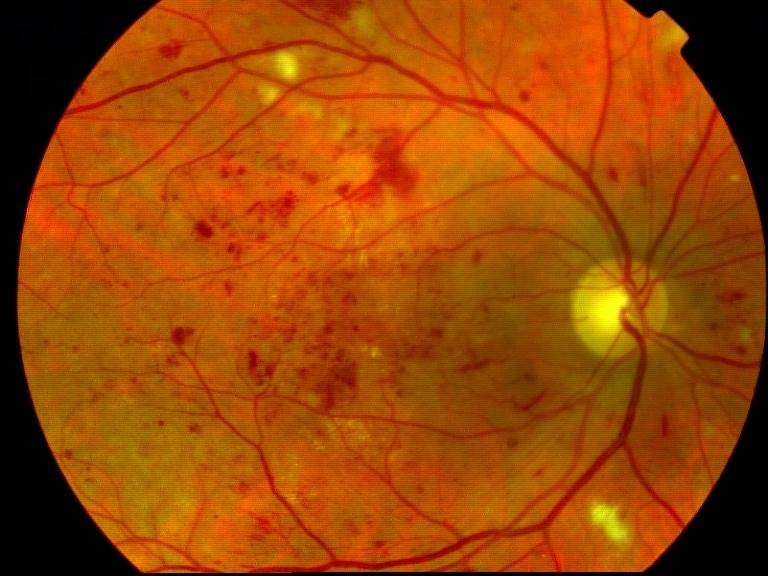 centre-ophtalmologie-la-ciotat-docteur-jerome-madar-materiel-retinographie-en-couleurs-03