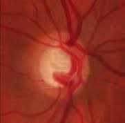 centre-ophtalmologie-la-ciotat-docteur-jerome-madar-materiel-retinographie-en-couleurs-04