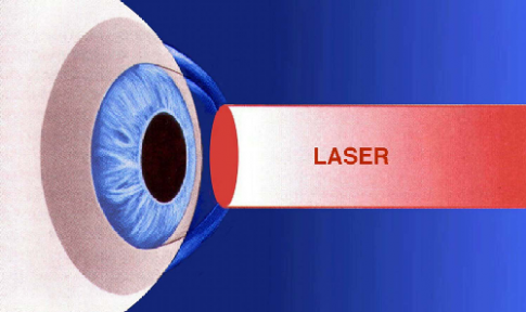 centre-ophtalmologie-la-ciotat-docteur-jerome-madar-chirurgie-refractive-au-laser-excimer-02