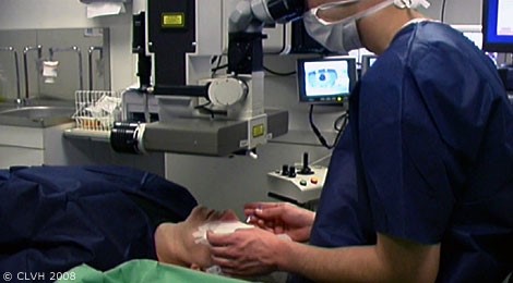 docteur-jerome-madar-la-ciotat-ophtalmologue-la-chirurgie-refractive-au-laser-excimer-deroulement-pratique-06